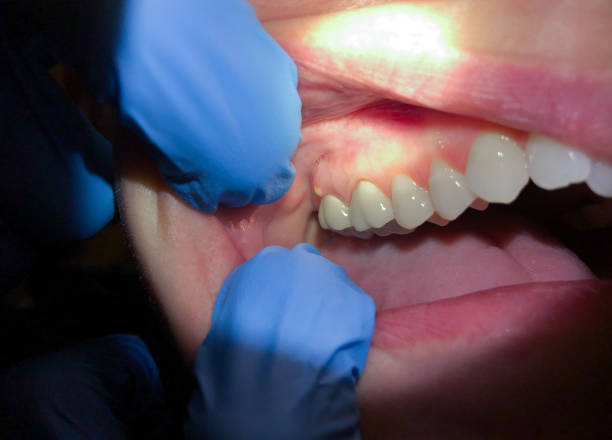 Best Emergency Cosmetic Dentistry in Caon City, CO