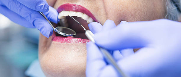Best Emergency Dentist for Knocked-Out Tooth in Caon City, CO